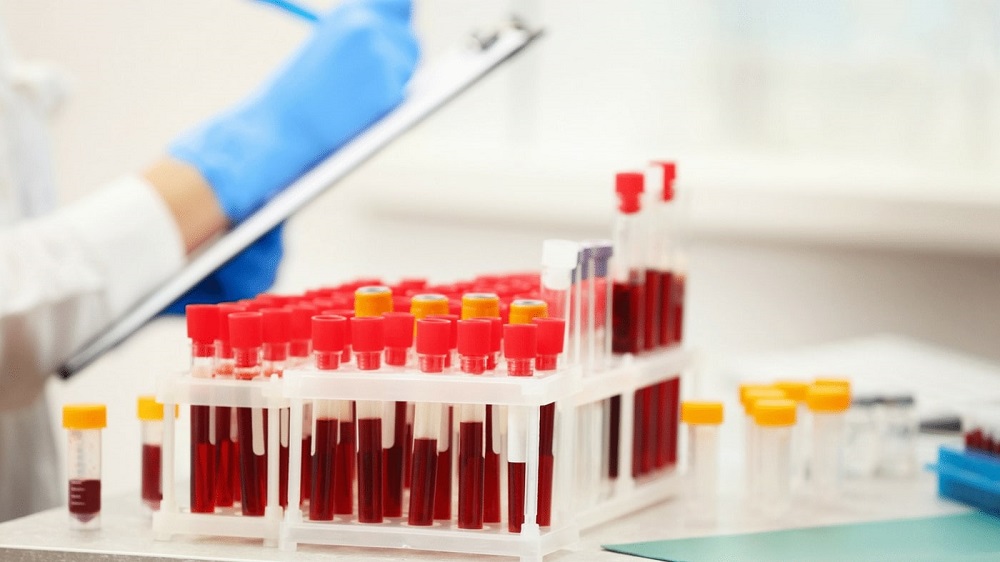 Анализ крови