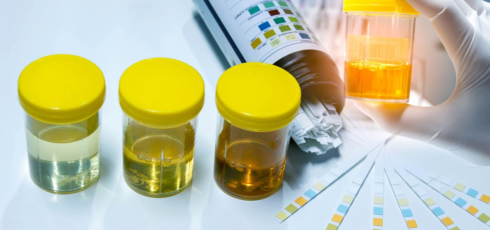 Тест на амфетамин