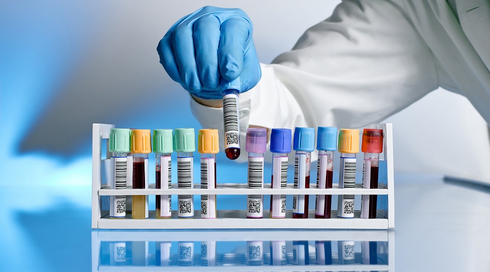 Способы установления факта употребления героина: виды исследования