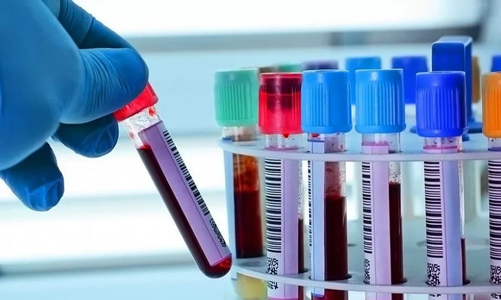 Время выведения дезоморфина из организма