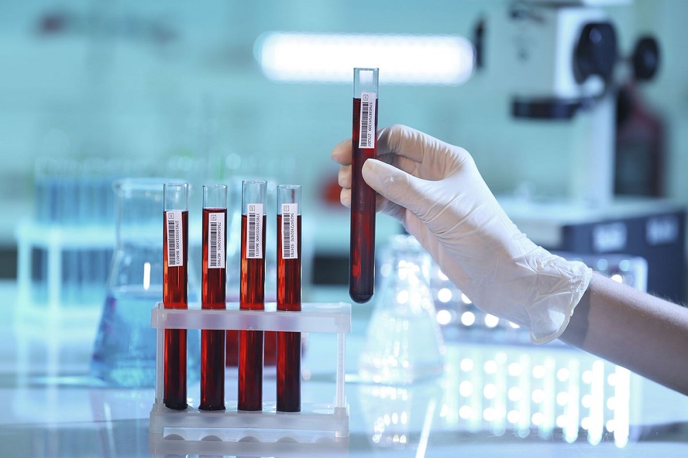 Тест на наркотик мефедрон