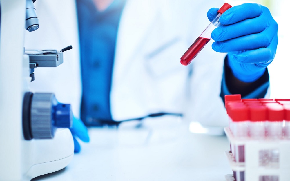 Выведение амфетамина из организма